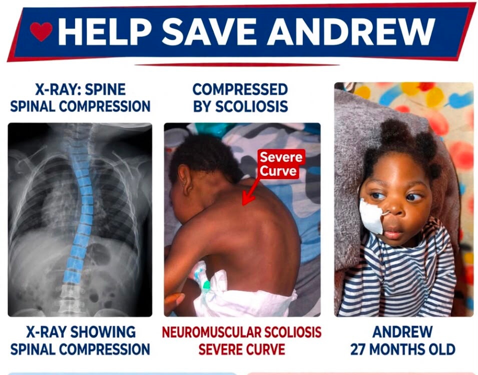 27-Month-Old Andrew Needs N4.2m for Life-Saving Spine Surgery, Family Appeals for Help